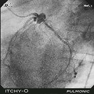 PATREON EXCLUSIVE Pulmonic